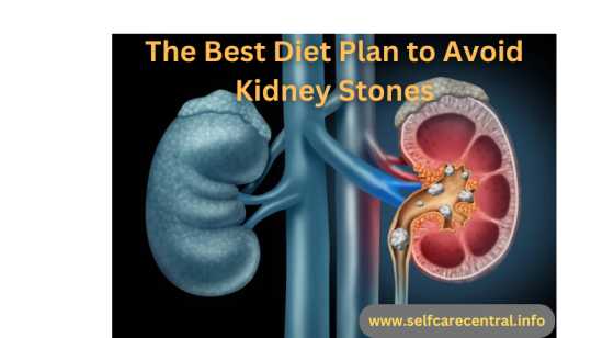 The Best Diet Plan to Avoid Kidney Stones